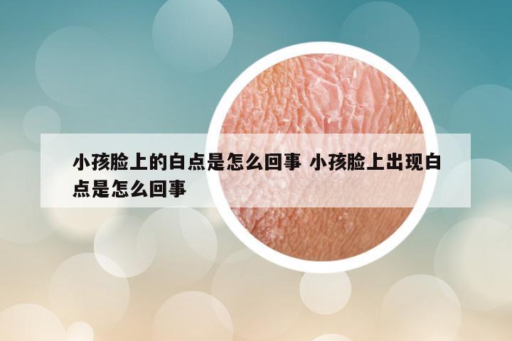 小孩脸上的白点是怎么回事 小孩脸上出现白点是怎么回事