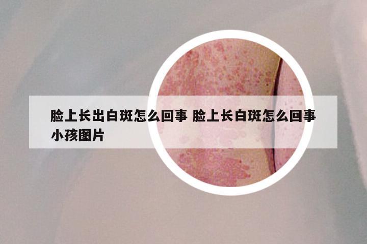 脸上长出白斑怎么回事 脸上长白斑怎么回事小孩图片