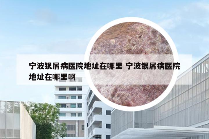宁波银屑病医院地址在哪里 宁波银屑病医院地址在哪里啊