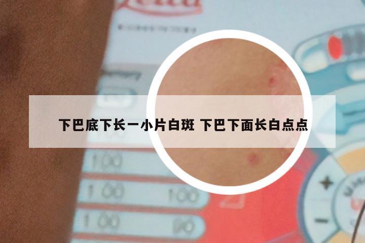 下巴底下长一小片白斑 下巴下面长白点点