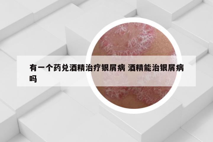 有一个药兑酒精治疗银屑病 酒精能治银屑病吗