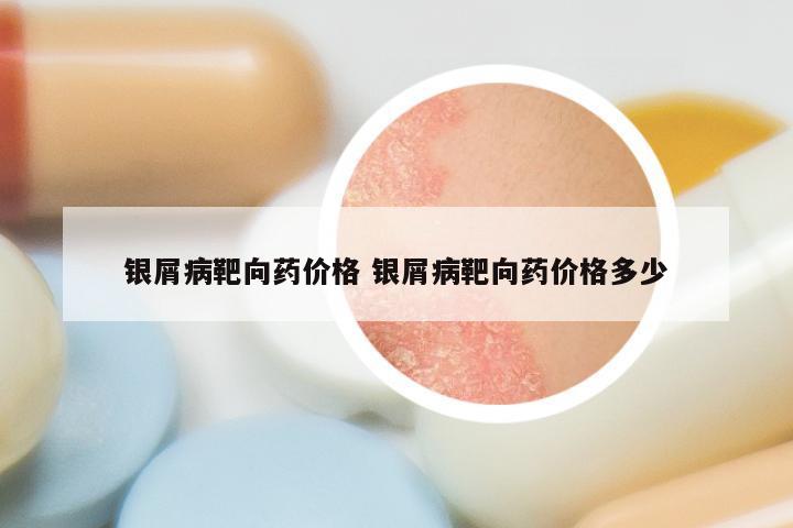 银屑病靶向药价格 银屑病靶向药价格多少