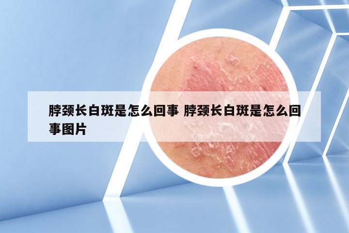 脖颈长白斑是怎么回事 脖颈长白斑是怎么回事图片