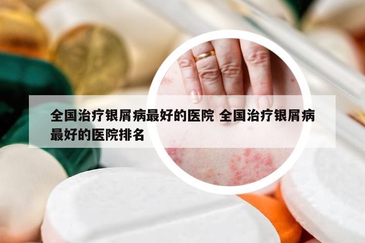 全国治疗银屑病最好的医院 全国治疗银屑病最好的医院排名