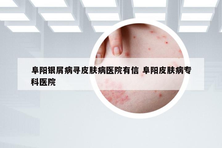 阜阳银屑病寻皮肤病医院有信 阜阳皮肤病专科医院