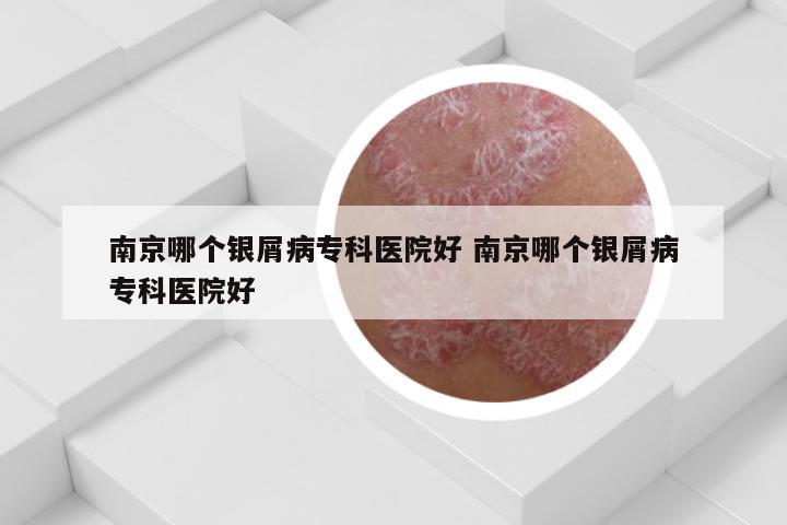 南京哪个银屑病专科医院好 南京哪个银屑病专科医院好