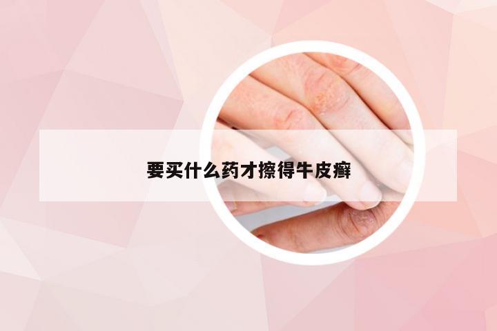 要买什么药才擦得牛皮癣