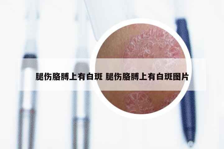 腿伤胳膊上有白斑 腿伤胳膊上有白斑图片