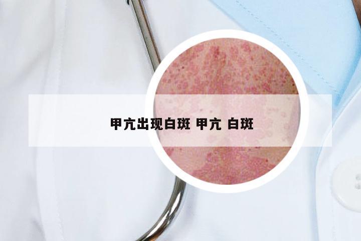 甲亢出现白斑 甲亢 白斑