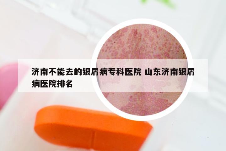 济南不能去的银屑病专科医院 山东济南银屑病医院排名