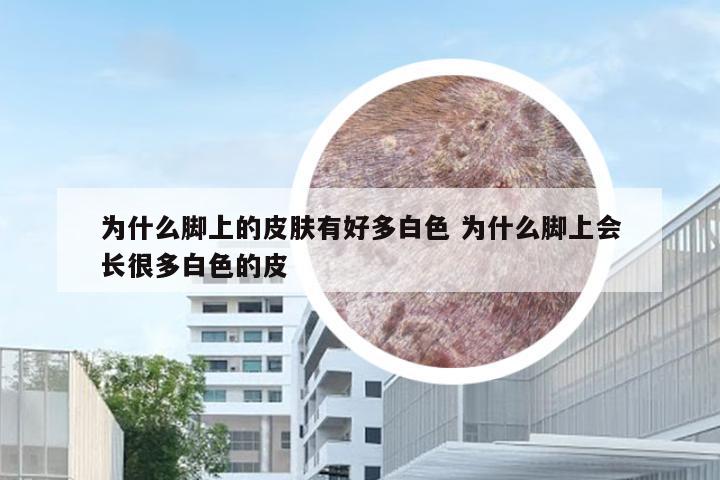 为什么脚上的皮肤有好多白色 为什么脚上会长很多白色的皮