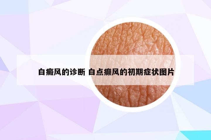 白癜风的诊断 白点癫风的初期症状图片