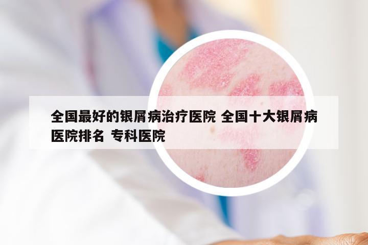 全国最好的银屑病治疗医院 全国十大银屑病医院排名 专科医院