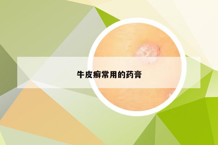 牛皮癣常用的药膏