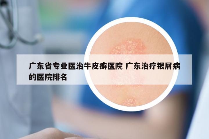 广东省专业医治牛皮癣医院 广东治疗银屑病的医院排名