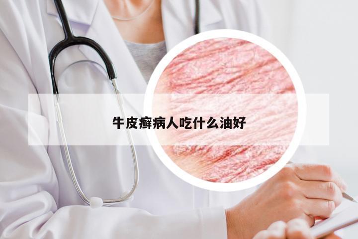 牛皮癣病人吃什么油好