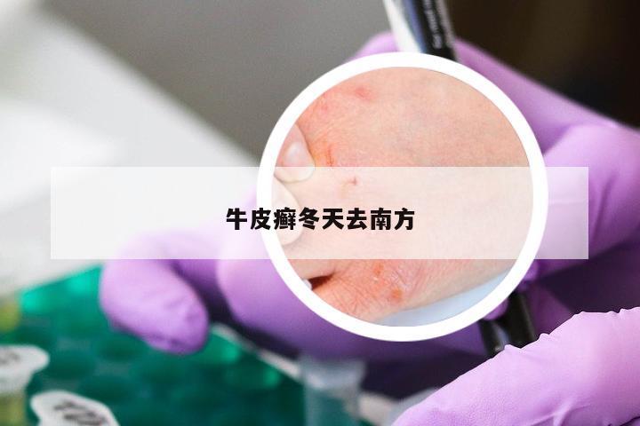 牛皮癣冬天去南方