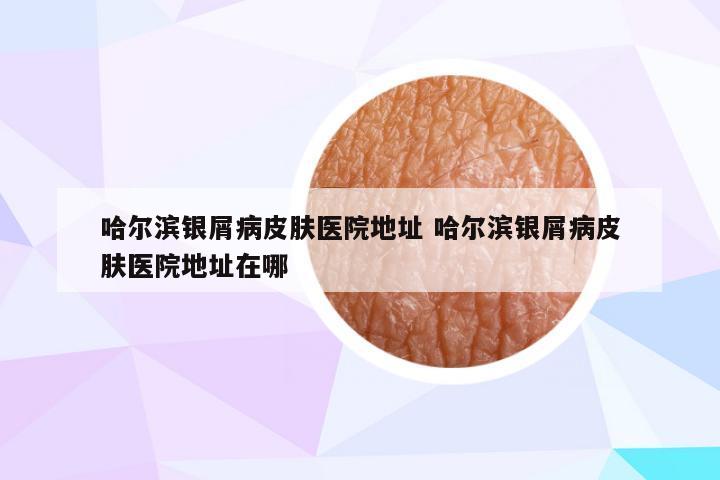 哈尔滨银屑病皮肤医院地址 哈尔滨银屑病皮肤医院地址在哪