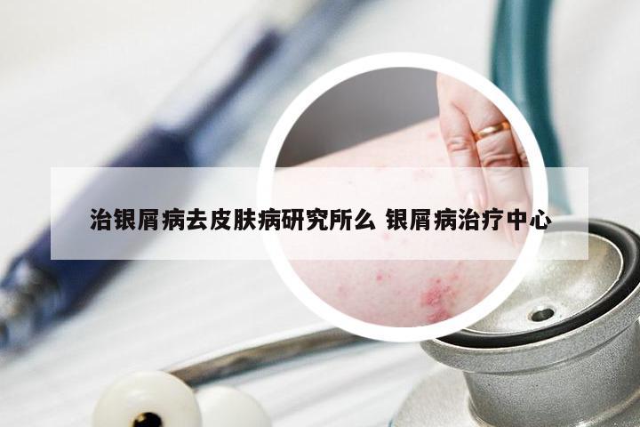 治银屑病去皮肤病研究所么 银屑病治疗中心