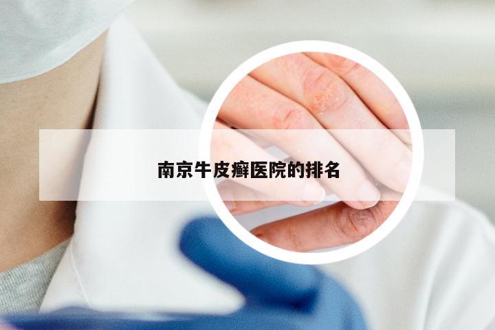 南京牛皮癣医院的排名