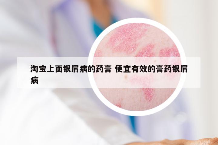 淘宝上面银屑病的药膏 便宜有效的膏药银屑病
