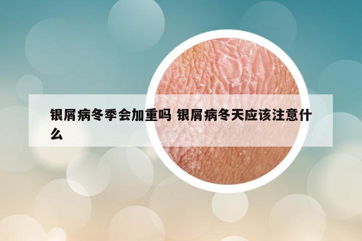 银屑病冬季会加重吗 银屑病冬天应该注意什么