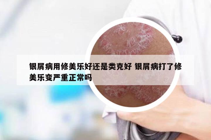 银屑病用修美乐好还是类克好 银屑病打了修美乐变严重正常吗
