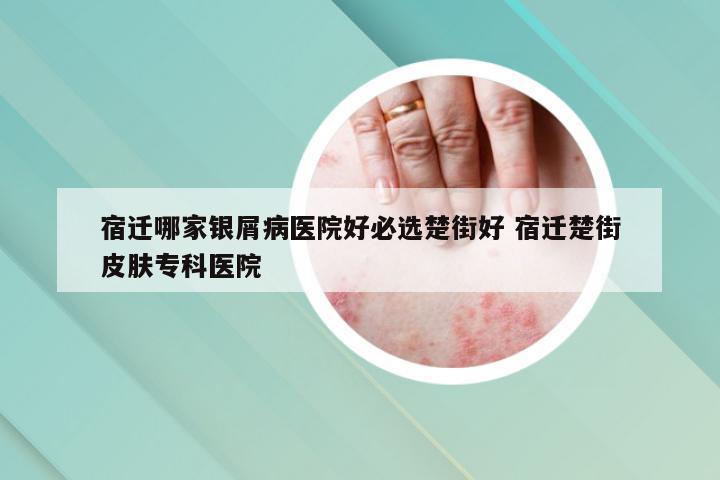 宿迁哪家银屑病医院好必选楚街好 宿迁楚街皮肤专科医院