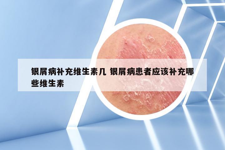 银屑病补充维生素几 银屑病患者应该补充哪些维生素