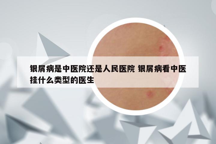 银屑病是中医院还是人民医院 银屑病看中医挂什么类型的医生