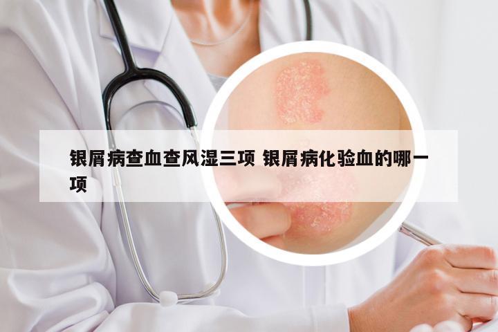 银屑病查血查风湿三项 银屑病化验血的哪一项