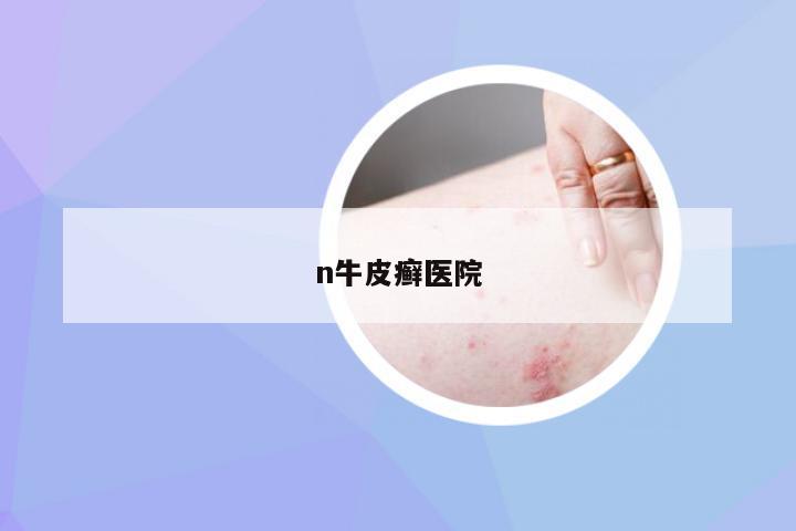 n牛皮癣医院