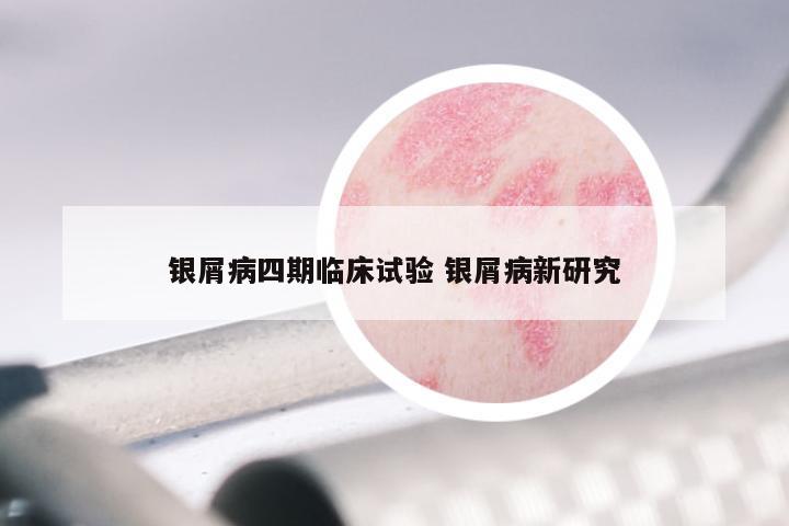 银屑病四期临床试验 银屑病新研究