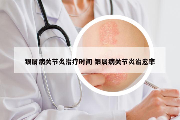银屑病关节炎治疗时间 银屑病关节炎治愈率