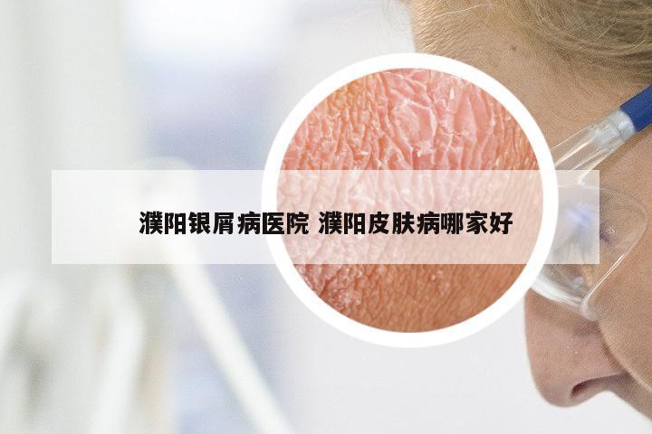 濮阳银屑病医院 濮阳皮肤病哪家好