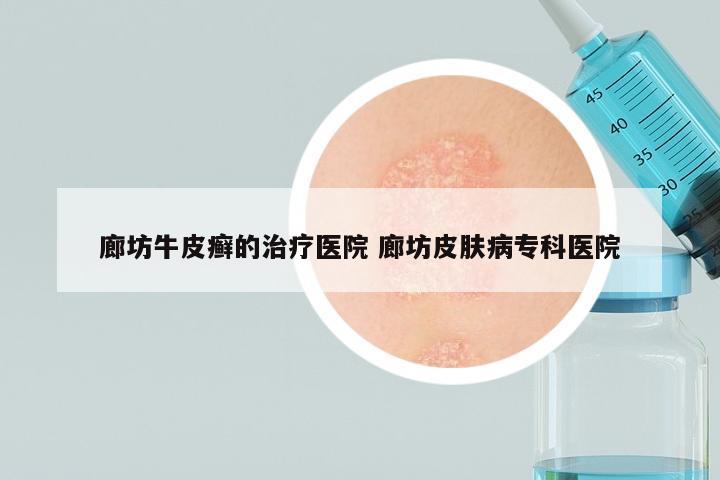 廊坊牛皮癣的治疗医院 廊坊皮肤病专科医院