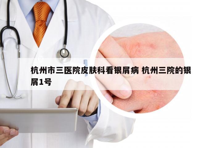 杭州市三医院皮肤科看银屑病 杭州三院的银屑1号