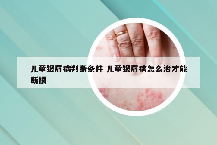 儿童银屑病判断条件 儿童银屑病怎么治才能断根
