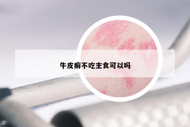 牛皮癣不吃主食可以吗