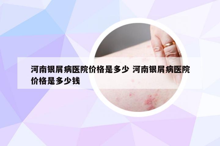 河南银屑病医院价格是多少 河南银屑病医院价格是多少钱