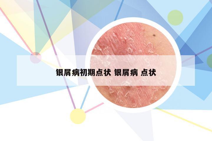 银屑病初期点状 银屑病 点状