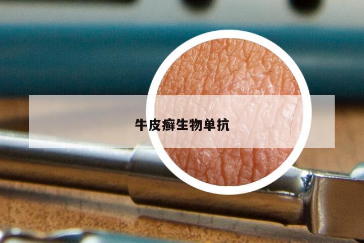 牛皮癣生物单抗