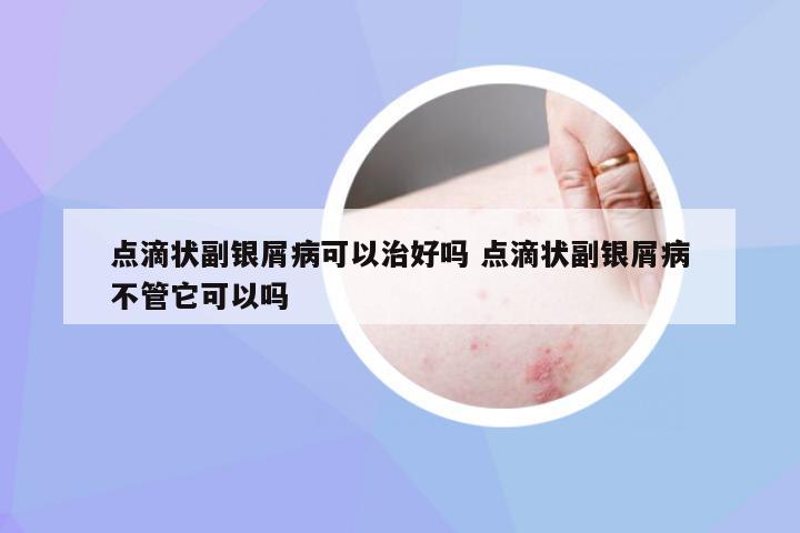 点滴状副银屑病可以治好吗 点滴状副银屑病不管它可以吗