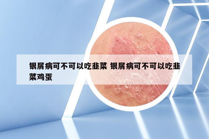 银屑病可不可以吃韭菜 银屑病可不可以吃韭菜鸡蛋