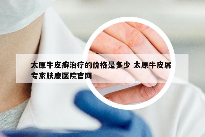 太原牛皮癣治疗的价格是多少 太原牛皮屑 专家肤康医院官网