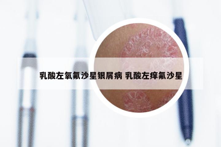 乳酸左氧氟沙星银屑病 乳酸左痒氟沙星