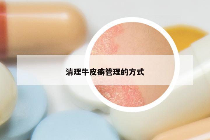 清理牛皮癣管理的方式