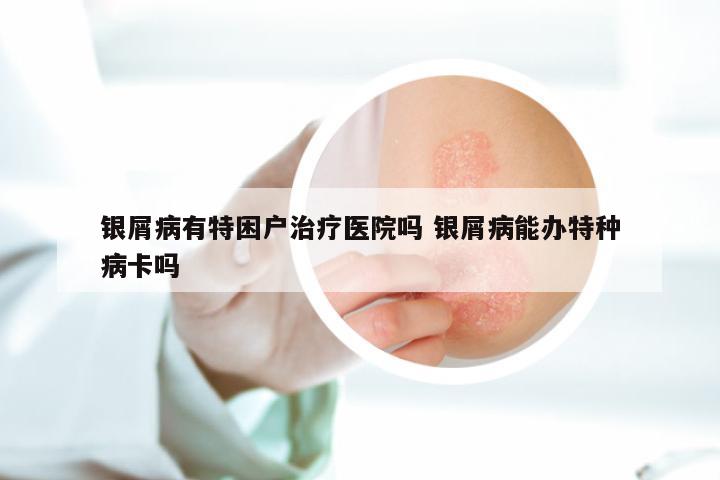 银屑病有特困户治疗医院吗 银屑病能办特种病卡吗