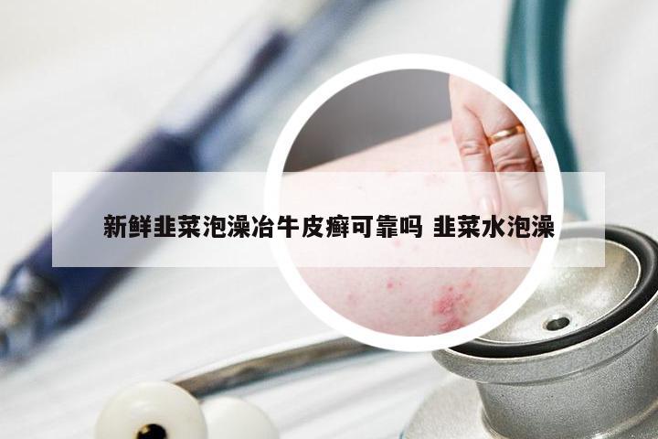 新鲜韭菜泡澡冶牛皮癣可靠吗 韭菜水泡澡