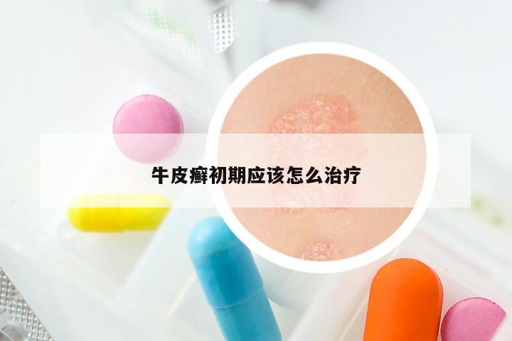 牛皮癣初期应该怎么治疗